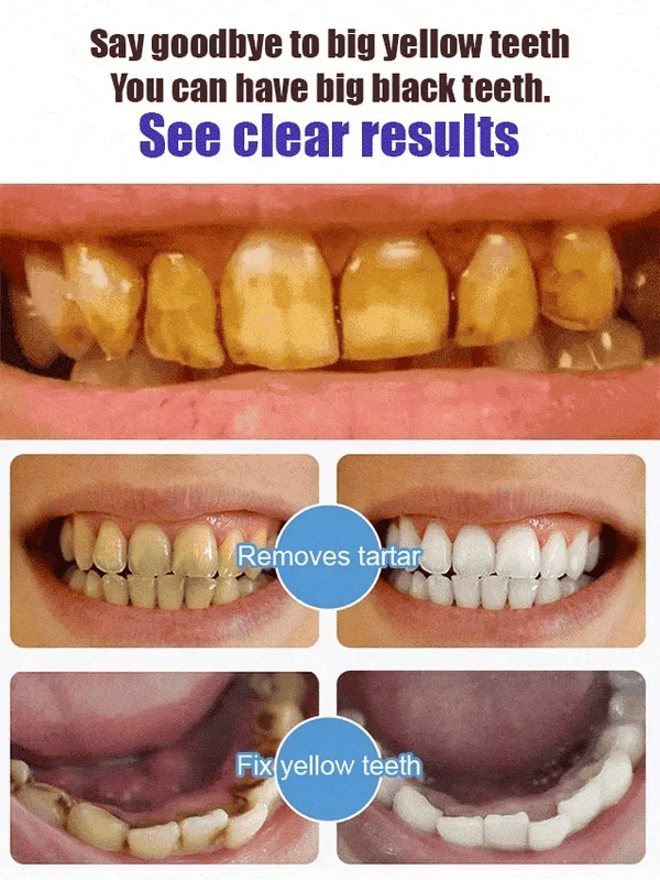💥 2026 Limited 50% OFF ️🦷 SP-6 Super Probiotic Toothpaste Advanced Oral Care