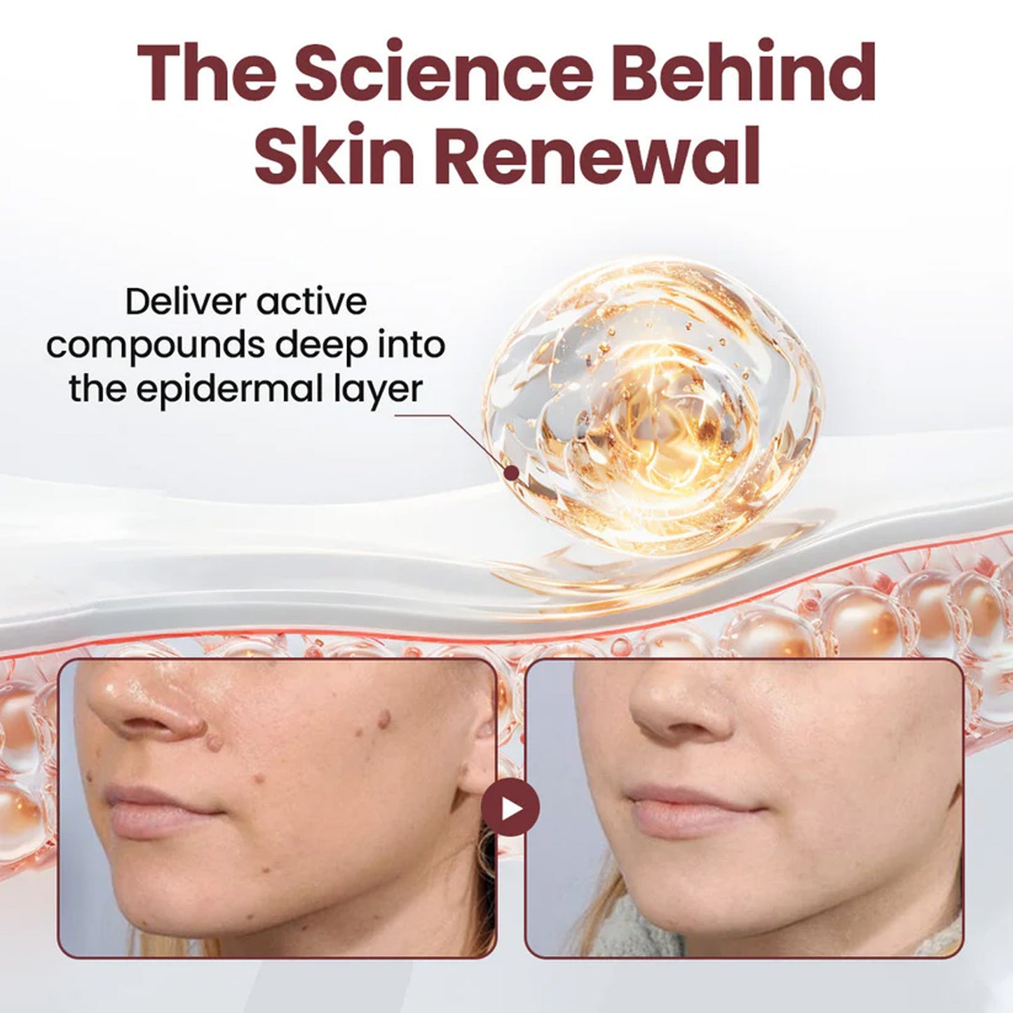 🔥 2026 Holiday Sale 70% OFF ✨ Unpree® KeraErase Dual-Action Renewal Cream