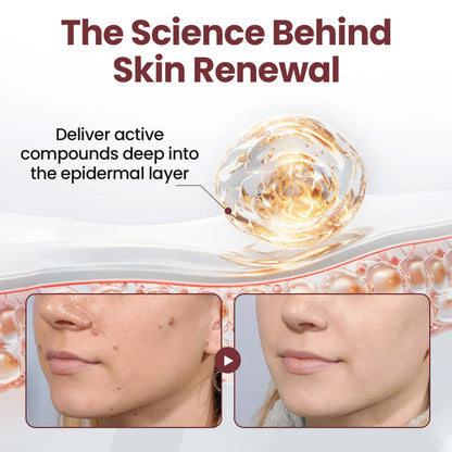 🔥 2026 Holiday Sale 70% OFF ✨ Unpree® KeraErase Dual-Action Renewal Cream