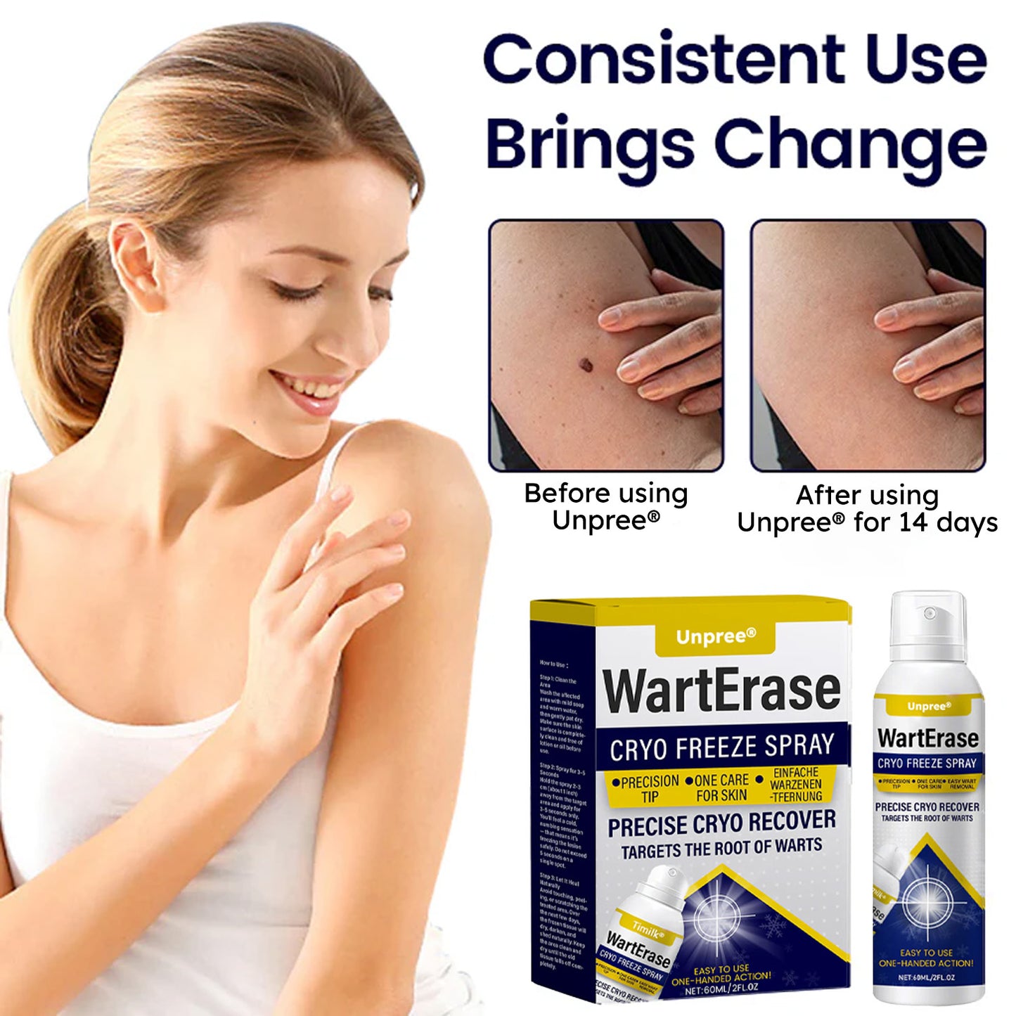 🔥 2026 Holiday Sale 70% OFF ✨ Unpree® WartErase Cryo Freeze Spray