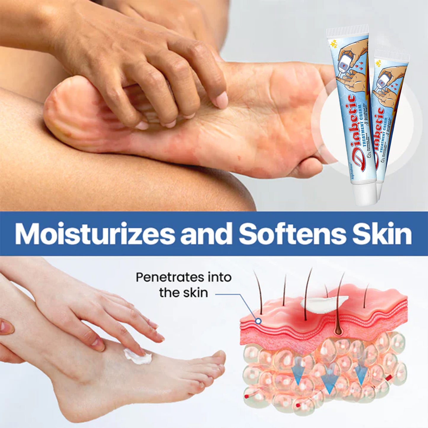 🔥 Flash Sale 70% OFF 🔥 AlphaRaw® VitaGluco Diabetes Treatment Cream