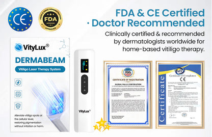 💥 VityLux® DermaBeam Vitiligo Laser Therapy System 🔆 3-5 Seconds Vitiligo Treatment - 2 Weeks To Visibly Better Skin