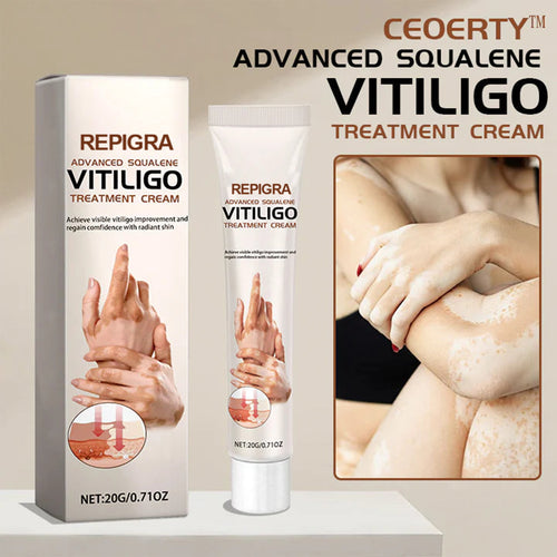 💥 2025 Mega Sale 70% OFF 🔥 Repigra Vitiligo Therapeutic Cream 🔆 Repigment With Care Every Day