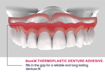 🎃 Halloween Pre-Sale 💥 75% OFF — BONDX Thermoplastic Denture Adhesive