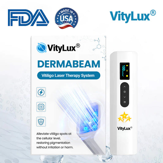 💥 VityLux® DermaBeam Vitiligo Laser Therapy System 🔆 3-5 Seconds Vitiligo Treatment - 2 Weeks To Visibly Better Skin