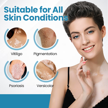 💥 VityLux® DermaBeam Vitiligo Laser Therapy System 🔆 3-5 Seconds Vitiligo Treatment - 2 Weeks To Visibly Better Skin