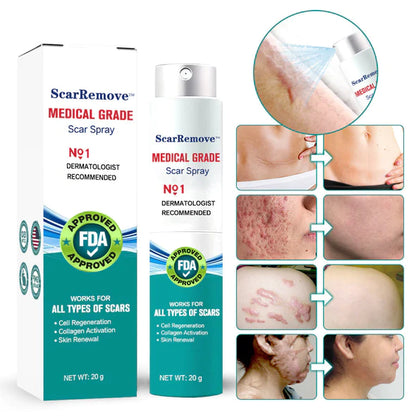 ScarRemove For All Types of Scars (Acne Scars, Tattoos Scars, Surgical Scars, Stretch Marks) ⚡️⚡️⚡️