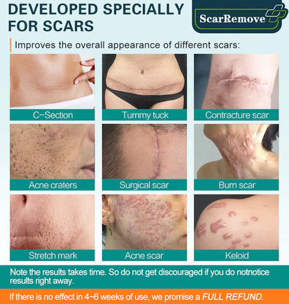 ScarRemove For All Types of Scars (Acne Scars, Tattoos Scars, Surgical Scars, Stretch Marks) ⚡️⚡️⚡️