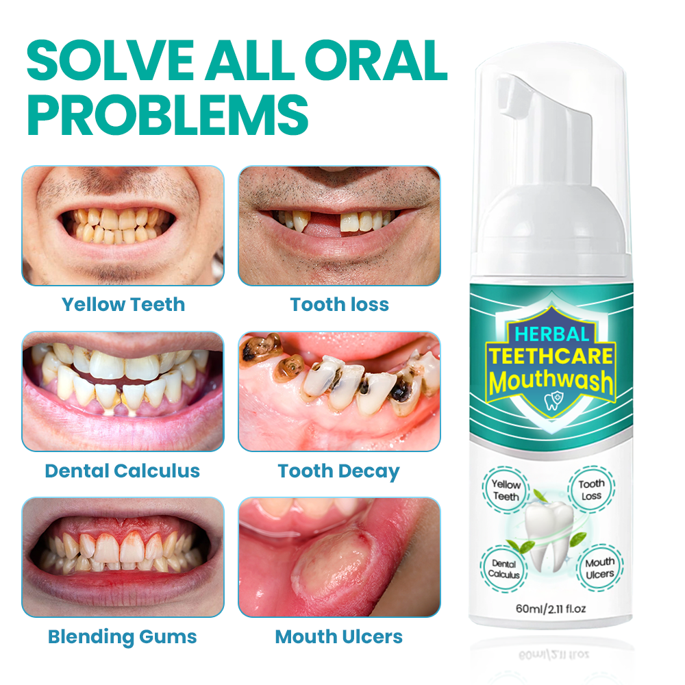 HERBAL TEETHCare Mouthwash - Solve All Oral Problems 🔥 LAST DAY SALE 70% OFF 🔥