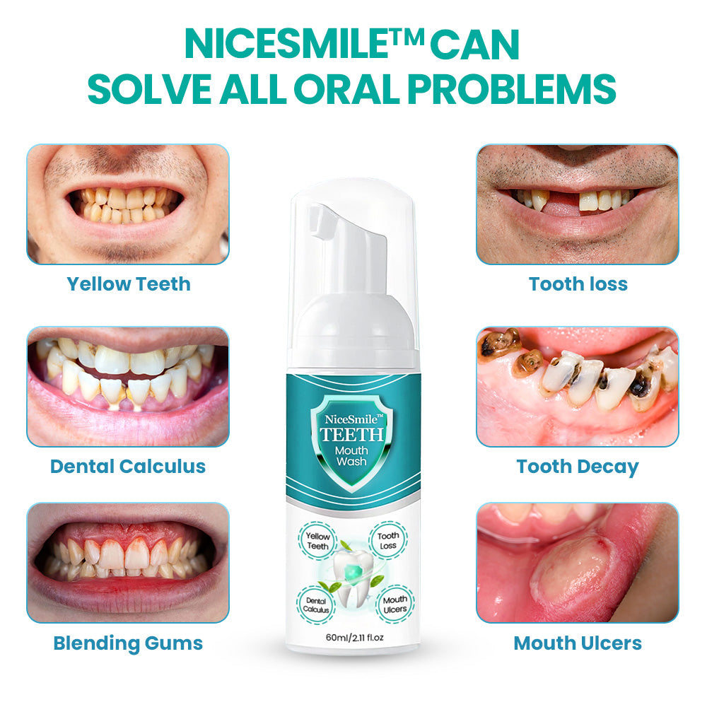 NiceSmile™ TEETH Mouthwash - Solve All Oral Problems 🔥 LAST DAY SALE 70% OFF 🔥