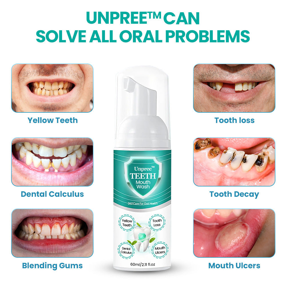 UNPREE™ Herbal Mouthwash Foam - Solve All Oral Problems 🔥 LAST DAY SALE 70% OFF 🔥