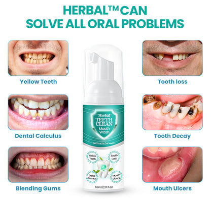 Herbal TEETHClean Mouthwash - Solve all Oral Problems 🔥 LAST DAY SALE 70% OFF 🔥