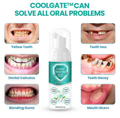 Coolgate™ TEETH Mouthwash - Solve All Oral Problems 🔥 LAST DAY SALE 70% OFF 🔥