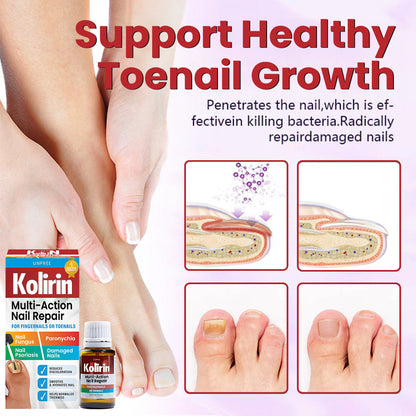 Unpree™ Kolirin Multi-Action Nail Repair Serum