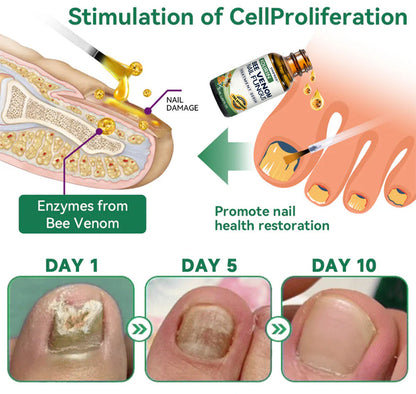 Unpree™ Kolirin Bee Venom Nail Fungus Treatment Serum