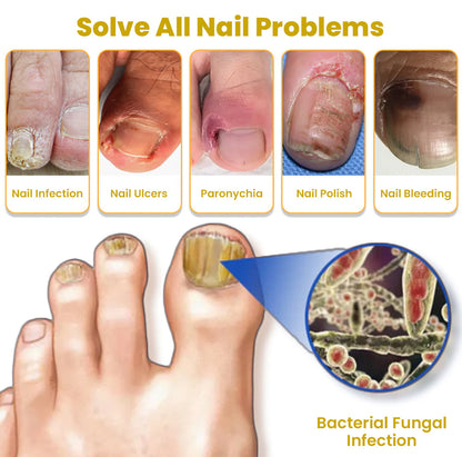 Unpree™ Kolirin Bee Venom Nail Growth And Repair Serum 🔥 Solve All Nail Problems
