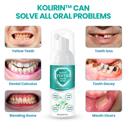 2026 Sale 70% OFF 🦷✨ Kolirin™ TEETH Herbal Mouthwash 🌿 Solve all Oral Problems