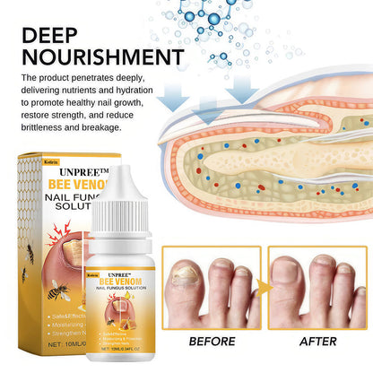 UNPREE™ Kolirin BeeVenom Nail Fungus Solution