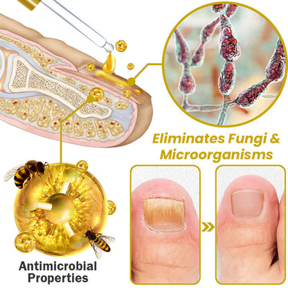 Unpree™ Kolirin Bee Venom Nail Growth And Repair Serum 🔥 Solve All Nail Problems
