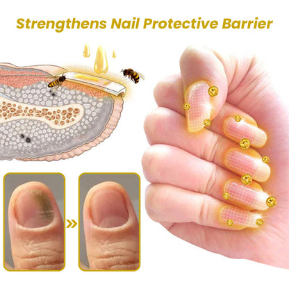 Unpree™ Kolirin Bee Venom Nail Growth And Repair Serum 🔥 Solve All Nail Problems