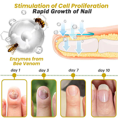 Unpree™ Kolirin Bee Venom Nail Growth And Repair Serum 🔥 Solve All Nail Problems