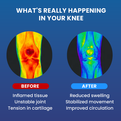 Father's Day SALE 65% OFF 🔥 KneeCore™ Adaptive Knee Support Brace