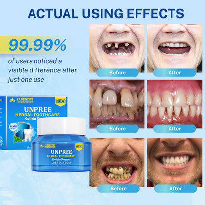 UNPREE™ Herbal ToothCare Kolirin Powder - Solve All Oral Problems 🔥 LAST DAY SALE 70% OFF 🔥
