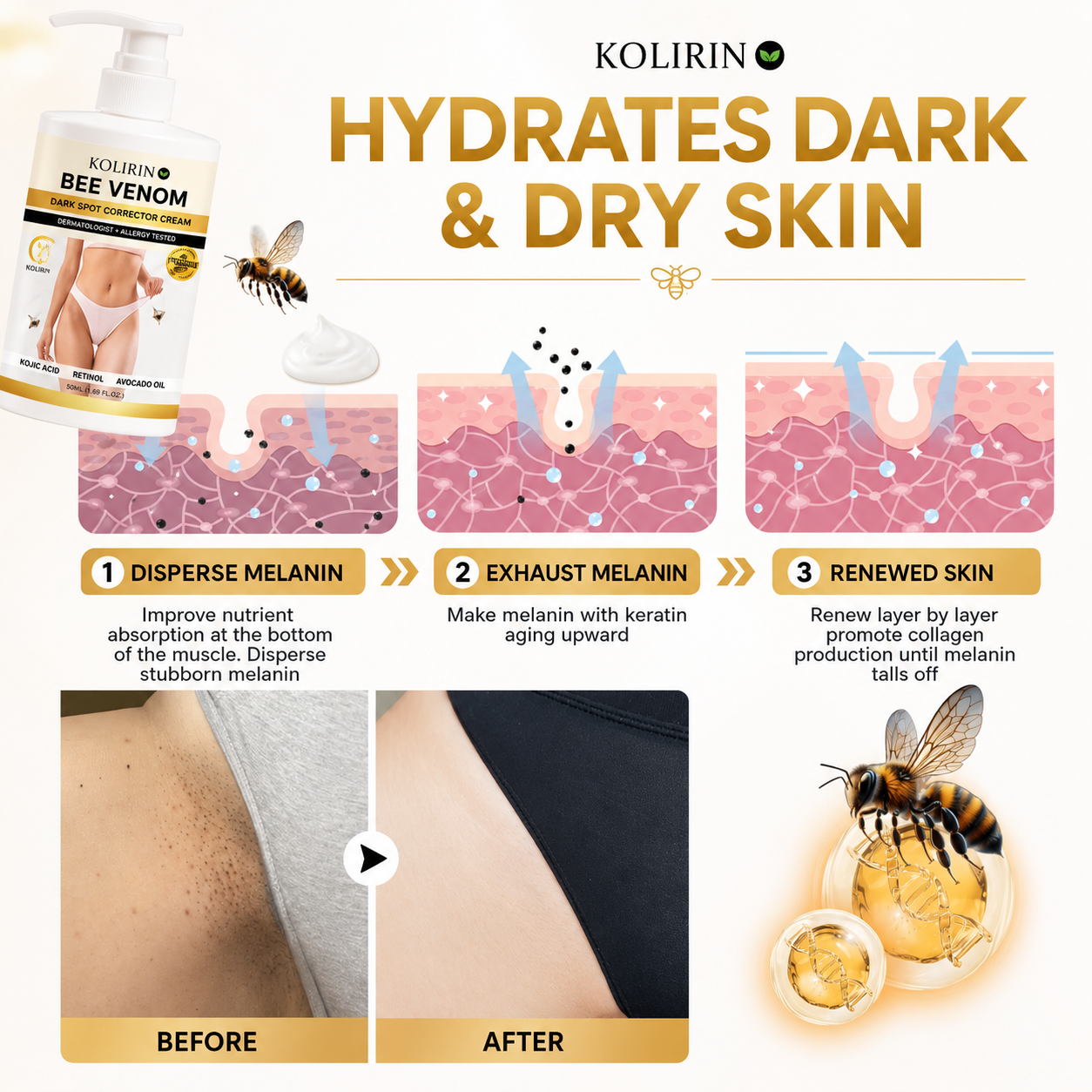 ⏳ Summer Deal 49% OFF ✨ Kolirin™ Bee Venom Dark Spot Corrector