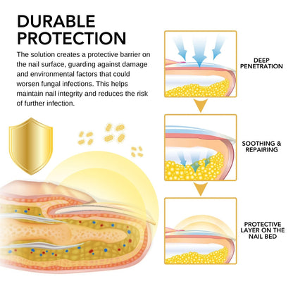 UNPREE™ Kolirin BeeVenom Nail Fungus Solution