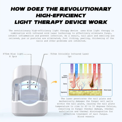 Suptruck™ NailFungal CleaningLaser TherapeuticDevice