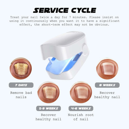 Suptruck™ NailFungal CleaningLaser TherapeuticDevice