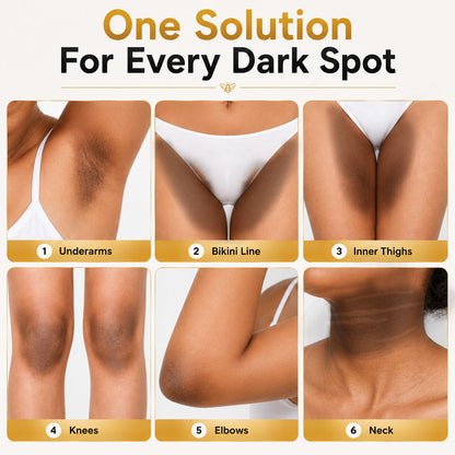 ⏳ Summer Deal 49% OFF ✨ Kolirin™ Bee Venom Dark Spot Corrector