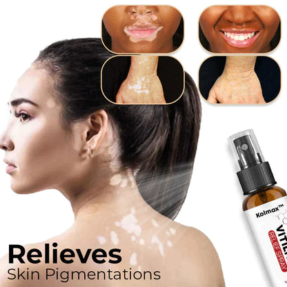 Vitiligo Relief Spray