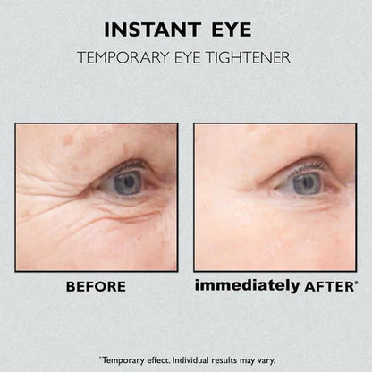 NoBags™ Instant Firming Eye Tightener