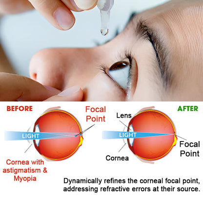 💥 2025 Limited 70% OFF ️⏳ UNPREE™ Kolirin Eye Care Drops