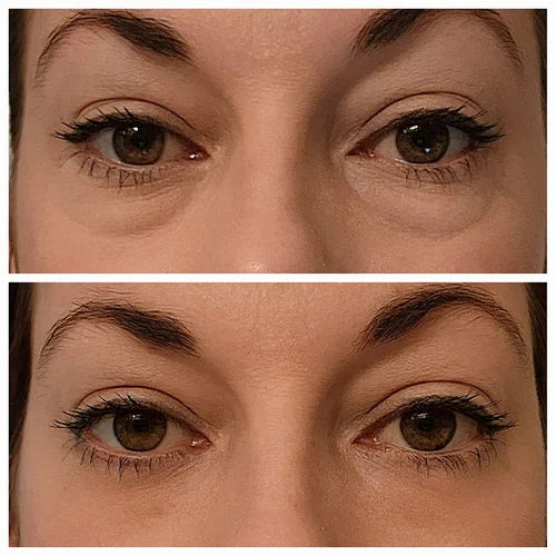 NoBags™ Instant Firming Eye Tightener