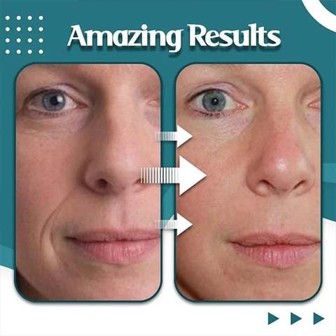 3D Face Lift-Up Roller Y Shape Massage Relaxation Tool - CERTIFI CURE