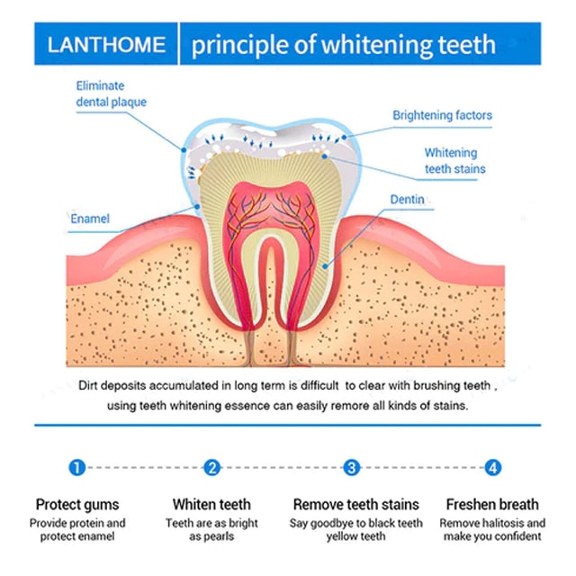 LANTHOME™ Teeth Whitening Essence