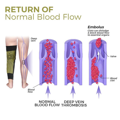 FEVERKNEE Double-side Self Heating Tourmaline Knee Shaping Sleeve (⭐⭐⭐⭐⭐ Limited time discount Last 30 minutes)